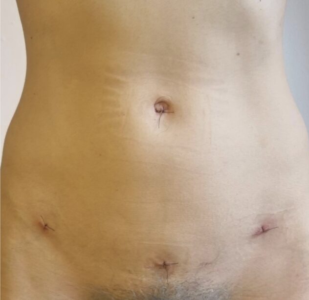 Auktion2024_Pongratz, Paula